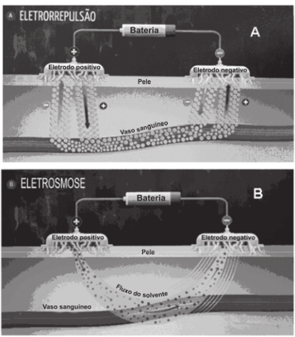 Como mostram as figuras, essa nova técnica baseia-se na aplicação de uma corrente elétrica de baixa intensidade sobre a pele do paciente