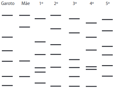 A figura mostra o resultado obtido após a identificação dos fragmentos dos DNA de cada um deles.